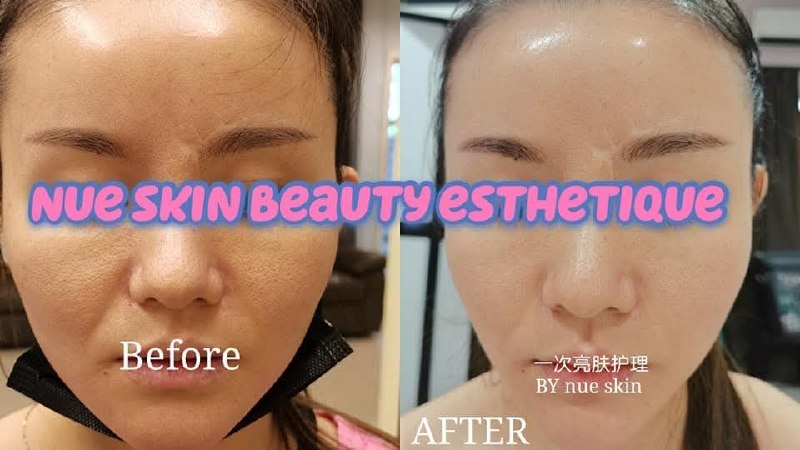 Brightening Treatment before and after — Nue Skin Beauty Esthetique