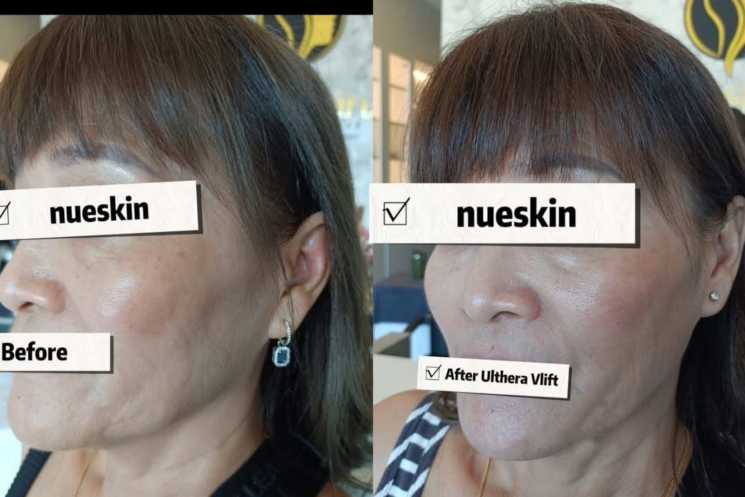 Face Contouring before and after — Nue Skin Beauty Esthetique