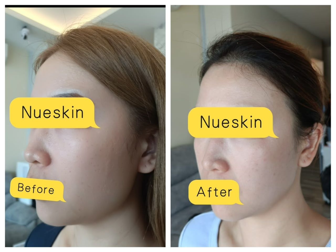 Facial treatment result with clearer brighter skin before and after — Nue Skin Beauty Esthetique
