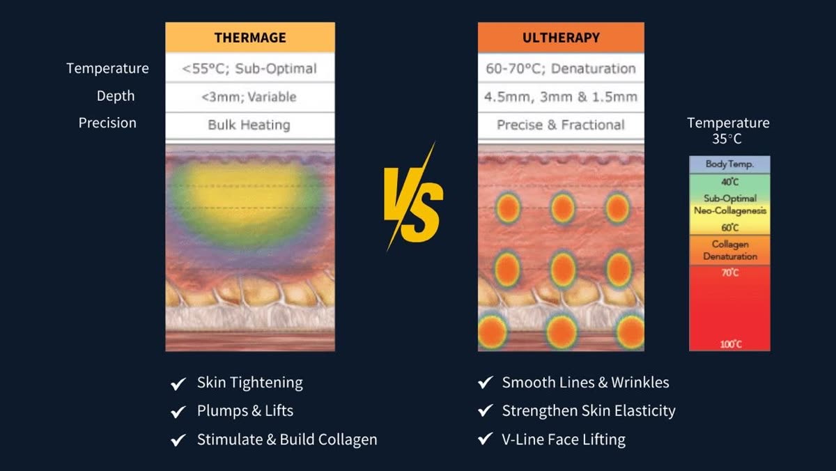 Thermage versus Ultherapy comparison diagram — temperature, depth and precision, plus skin tightening, plumping and collagen-building benefits — Nue Skin Beauty Esthetique